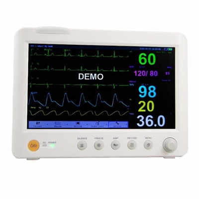 EKG/NIBP Portatif Çok Parametralı Hasta Monitörü Hastane İç Veri Depolama