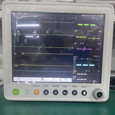 Kablolu/Kablosuz Bağlantı Özelliğine Sahip Taşınabilir Çok Parametreli Hasta Monitörü