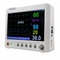 EKG/NIBP Portatif Çok Parametralı Hasta Monitörü Hastane İç Veri Depolama