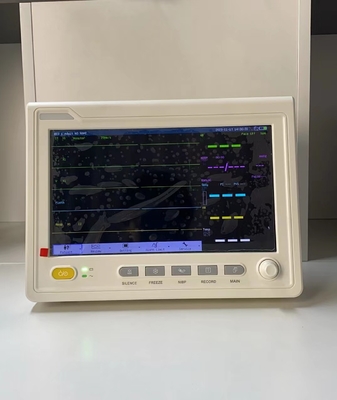 10.1 inç taşınabilir EKG makinesi hastane kullanımı için hayati belirtiler