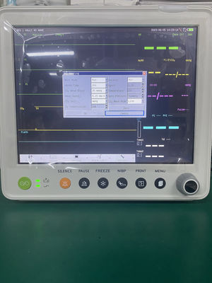 12.1'' Renkli TFT LCD Çok Parametreli Hasta Monitörü, 1 Yıl Garantili ve Kompakt 30*27*30CM Tasarım