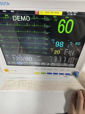 EKG SPO2 NIBP TEMP RESP ile taşınabilir yatak yanı monitörü Seçenekli ETCO2-Sınıf II 1 yıllık garanti